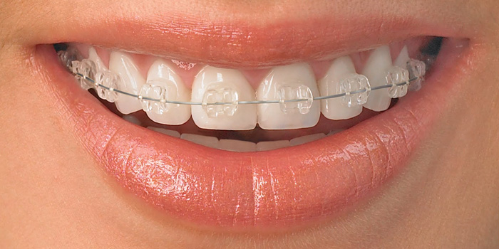 ORTHODONTICS - Dentistar