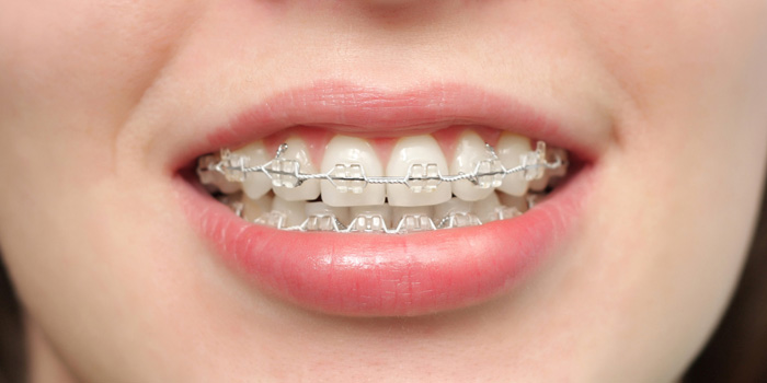 ORTHODONTICS - Dentistar